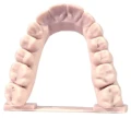 Model dentystyczny wydrukowany z żywicy Monocure3D PORCELENE™ Dental Almond