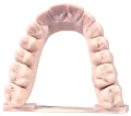 model wykonany z żywicy Monocure 3D Porcelene Dental (S) Almond a o matowym, porcelanowym wykończeniu do precyzyjnych modeli