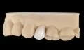 Profesjonalna żywica Graphy Tera Harz TC-80DP C&B A2 1 l kompatybilna z drukarkami 3D UV LED 405 nm do zastosowań protetycznych i stomatologicznych.