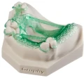 Żywica UV Graphy SC-130 Castable Green 100 g do wykonywania modeli protetycznych przeznaczonych do bezpośredniego odlewania elementów metalowych.